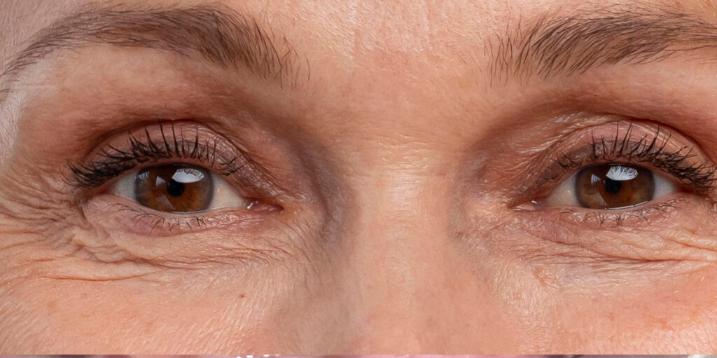 Close-up of a person’s brown eyes with visible eyelashes and skin texture around the eyes.